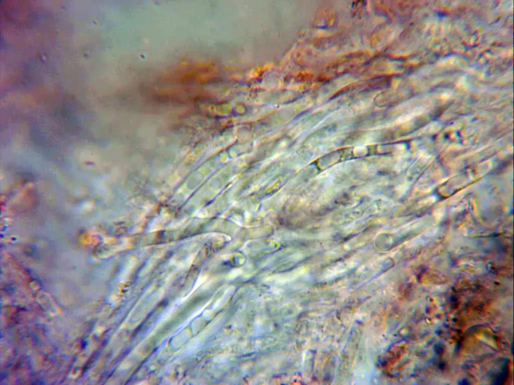 Microscopía de Sphaerobolus stellatus - 11 - Hifas cubierta